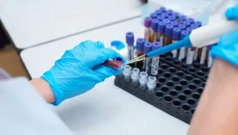 Blood sample in epruvete